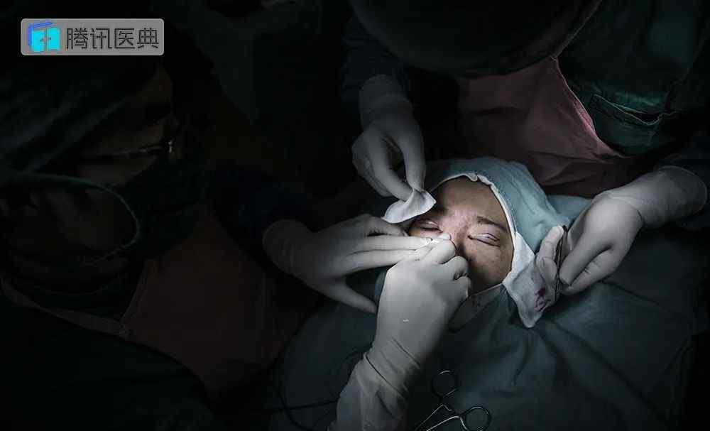 韩国整形美容医院 她去韩国做了12项整形手术 无一成功：整形 毁了多少中国女生的未来